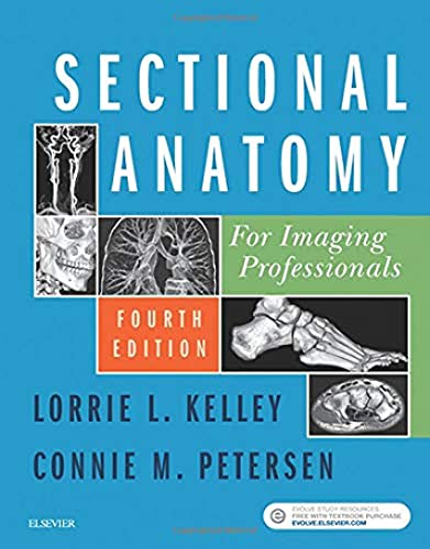 Sectional Anatomy for Imaging Professionals, 4e