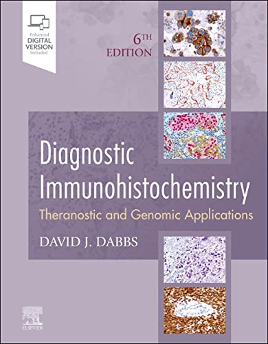 Diagnostic Immunohistochemistry: Theranostic and Genomic Applications, 6e