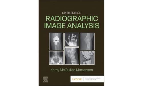Radiographic Image Analysis, 6e