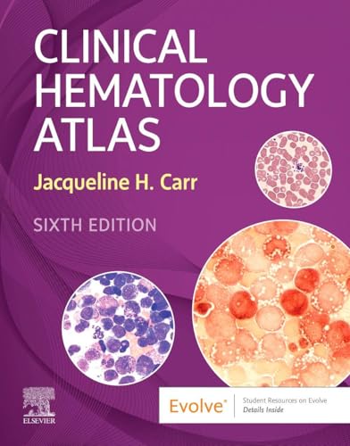 Clinical Hematology Atlas, 6e