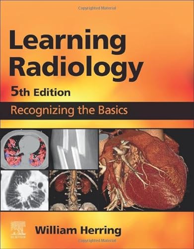 Learning Radiology: Recognizing the Basics, 5e