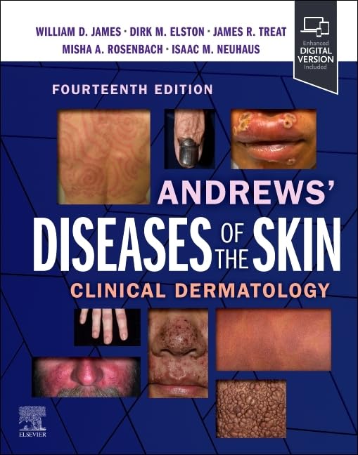 Andrews' Diseases of the Skin: Clinical Dermatology, 14e