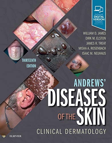 Andrews' Diseases of the Skin: Clinical Dermatology, 13e