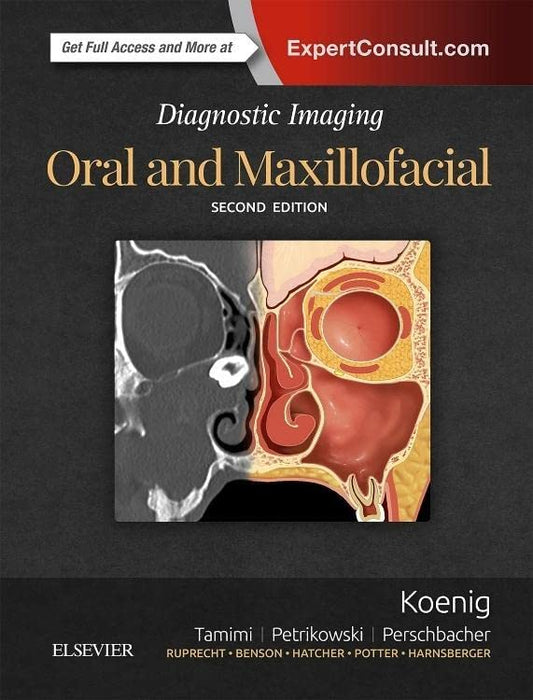 Diagnostic Imaging: Oral and Maxillofacial, 2e