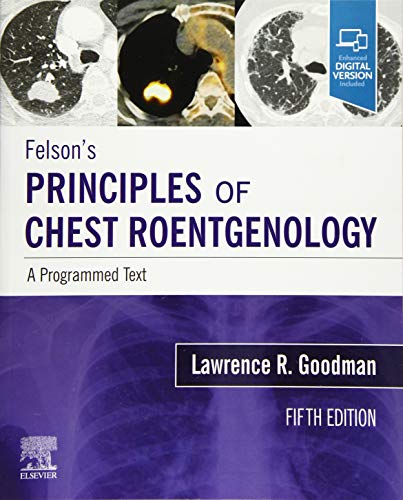 Felson's Principles of Chest Roentgenology, A Programmed Text, 5e